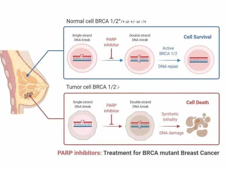 PARP inhibitor