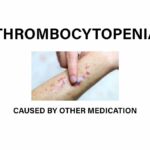 Thrombocytopenia can be caused by other medication
